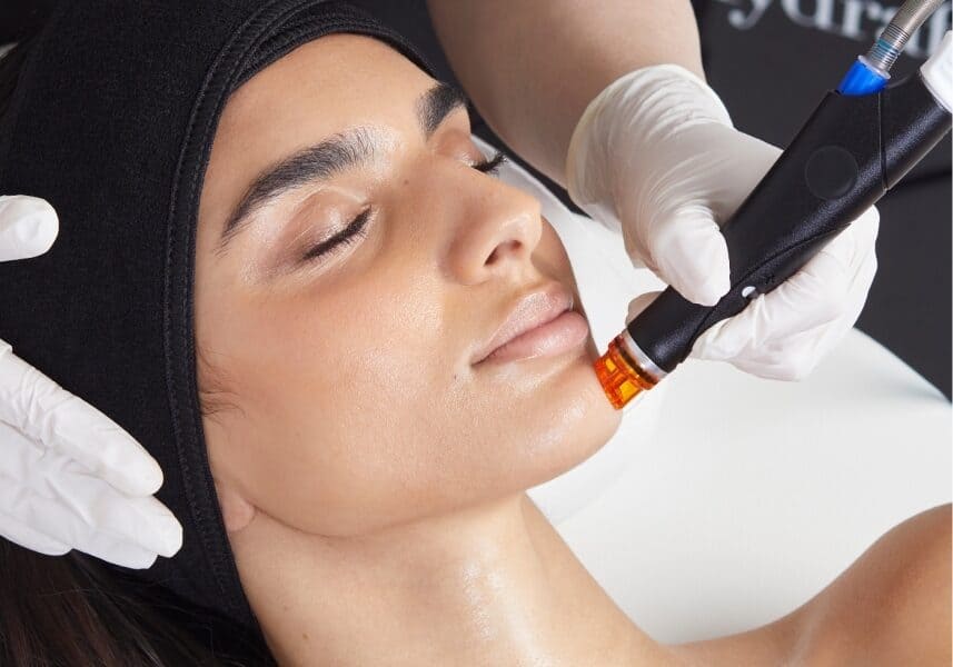 A woman undergoing a Hydrafacial treatment, lying with her eyes closed as a professional uses a specialized tool on her chin. The procedure highlights skincare and rejuvenation in a clinical setting.
