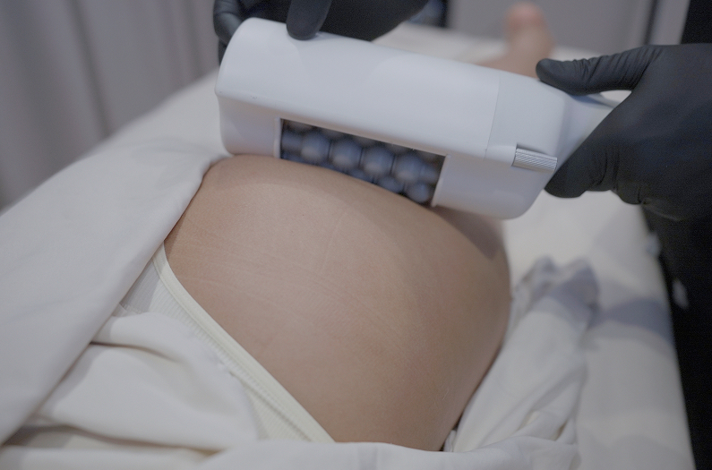 Representation of mesopheric massage used to enhance microcirculation and skin elasticity.